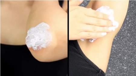 Hết thâm đầu gối khuỷu tay nhờ kem Hết thâm đầu gối khuỷu tay nhờ kem
