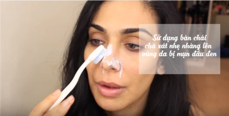 Trị mụn đầu đen với kem đánh răng Trị mụn đầu đen với kem đánh răng